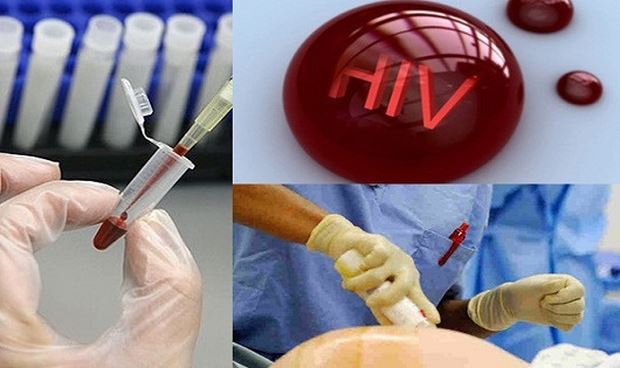Điều kiện xác định người bị phơi nhiễm HIV, người bị nhiễm HIV do tai nạn rủi ro nghề nghiệp. hiv1-169546384688744609582.jpg