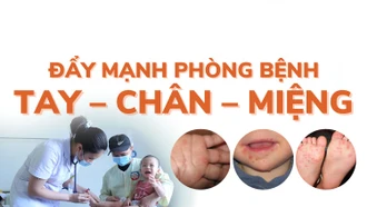 [Infographic] Bệnh tay - chân - miệng: dấu hiệu nhận biết và biện pháp phòng bệnh