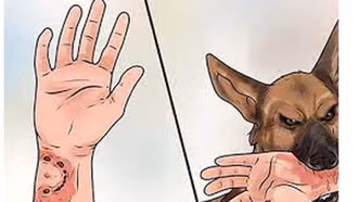 Bệnh dại có xu hướng gia tăng, thời gian ủ bệnh ngắn