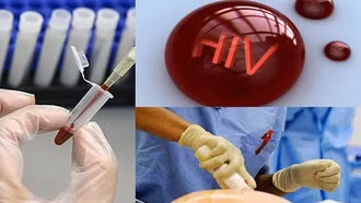 Điều kiện xác định người bị phơi nhiễm HIV, nhiễm HIV do tai nạn rủi ro nghề nghiệp