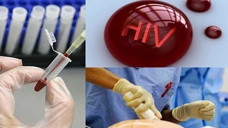 Điều kiện xác định người bị phơi nhiễm HIV, nhiễm HIV do tai nạn rủi ro nghề nghiệp