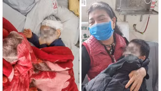 Bệnh viện Đa khoa tỉnh tiếp nhận điều trị 3 bố con bị chó dữ tấn công