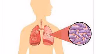 Tăng cường các giải pháp nhằm chấm dứt bệnh Lao vào năm 2030