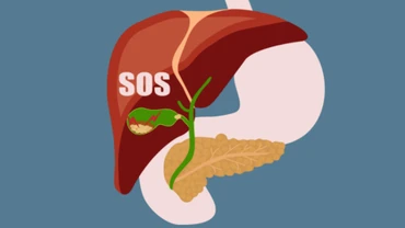 Infograhic: Những dấu hiệu cảnh báo gan đang quá tải
