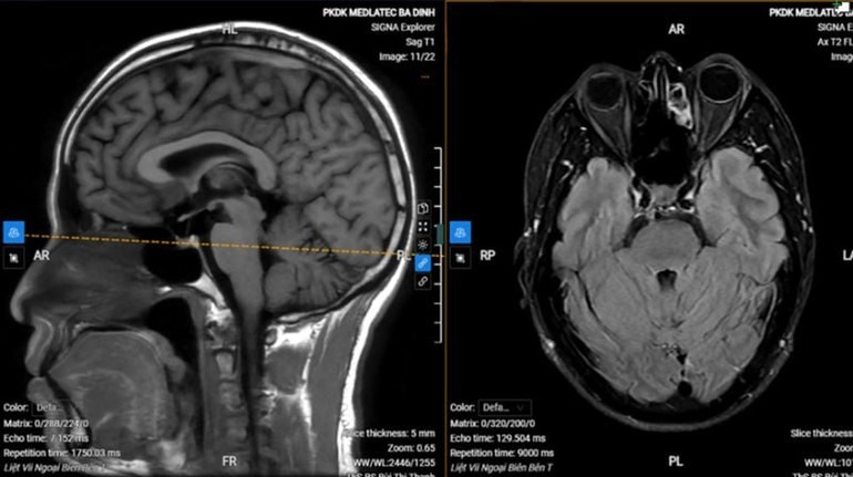 Hình ảnh chụp MRI của bệnh nhân.