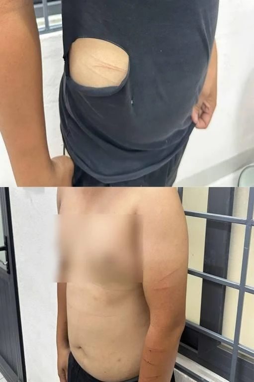 Huy thừa nhận đã tự dùng dao gây thương tích lên cơ thể, xé rách quần áo để tạo hiện trường giả rồi dựng chuyện bị cướp. (Ảnh: Công an Đắk Lắk)