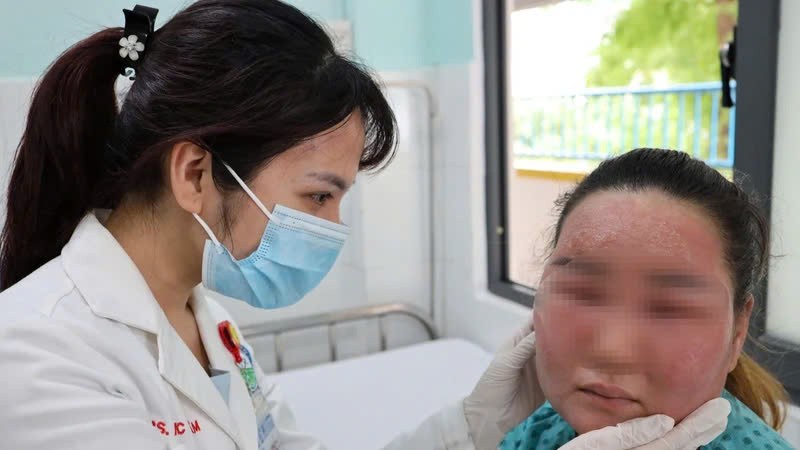 Một trường hợp biến chứng nặng trên da sau khi cùng sản phẩm peel da mua trên mạng.