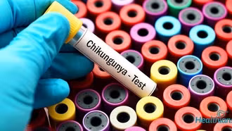 Không nên tự ý điều trị khi có dấu hiệu mắc Chikungunya