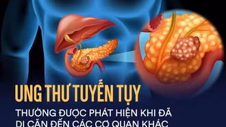 Cơ hội kéo dài thời gian sống của bệnh nhân ung thư tuyến tụy di căn
