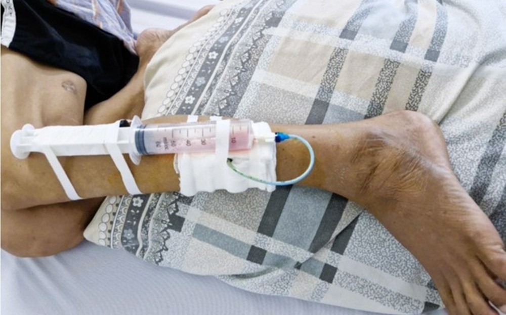 Phát hiện 4 ca nhiễm "vi khuẩn ăn thịt người" ở Quảng Ninh ảnh 1 Phát hiện 4 ca nhiễm "vi khuẩn ăn thịt người" ở Quảng Ninh ảnh 1