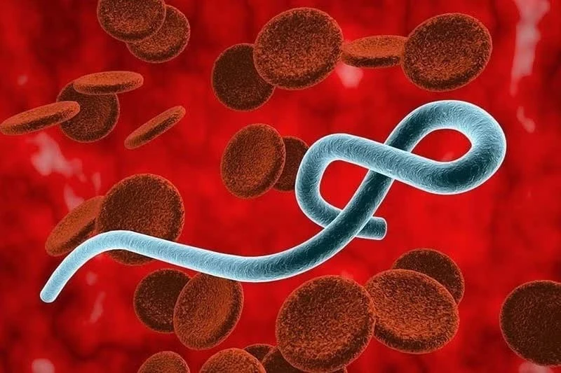 Virus Ebola.