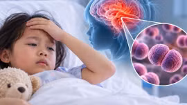 Não mô cầu nhóm B nguy hiểm thế nào, phòng bệnh ra sao?